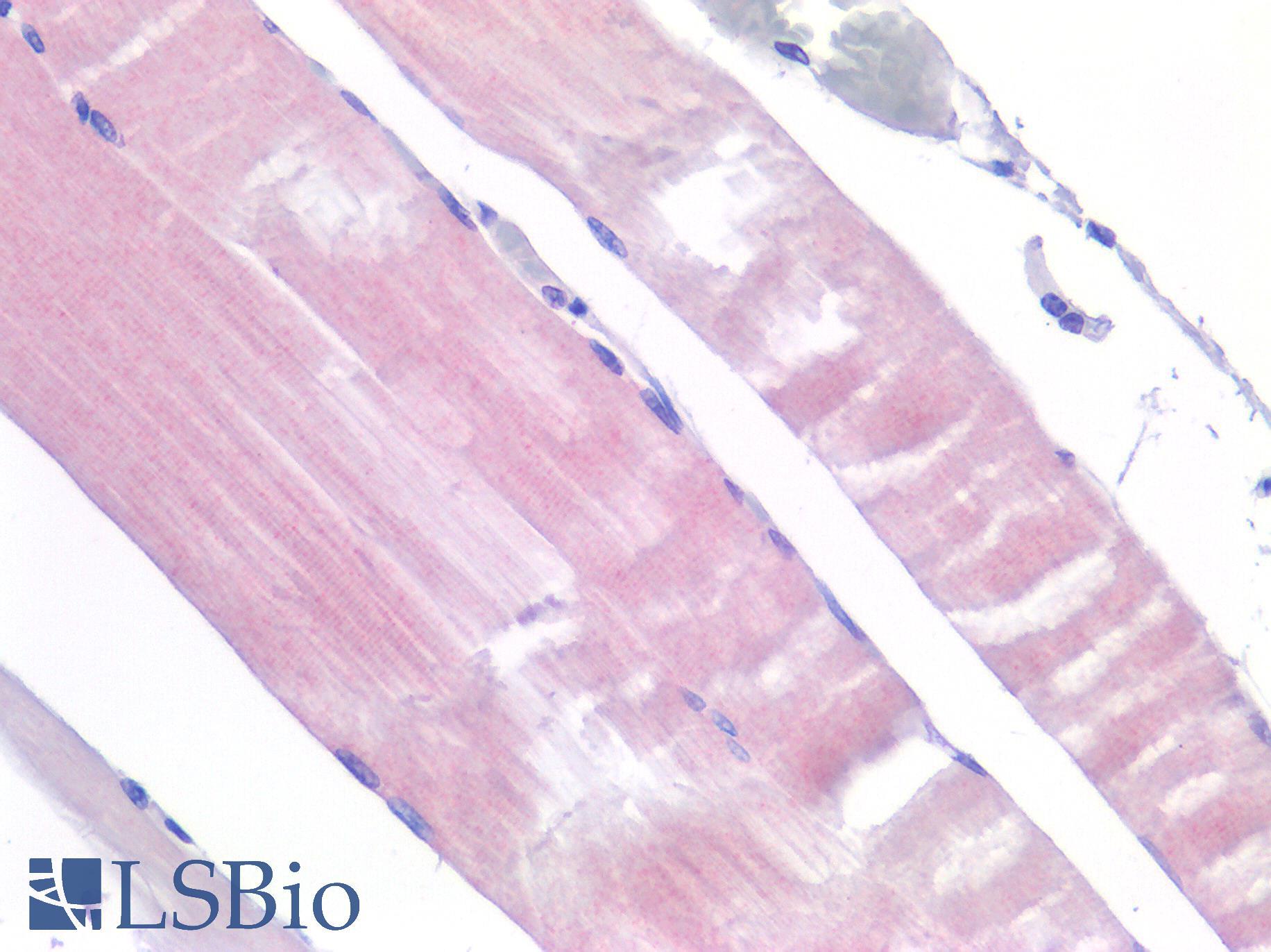 IL6R / IL6 Receptor Antibody - Human Skeletal Muscle: Formalin-Fixed, Paraffin-Embedded (FFPE)
