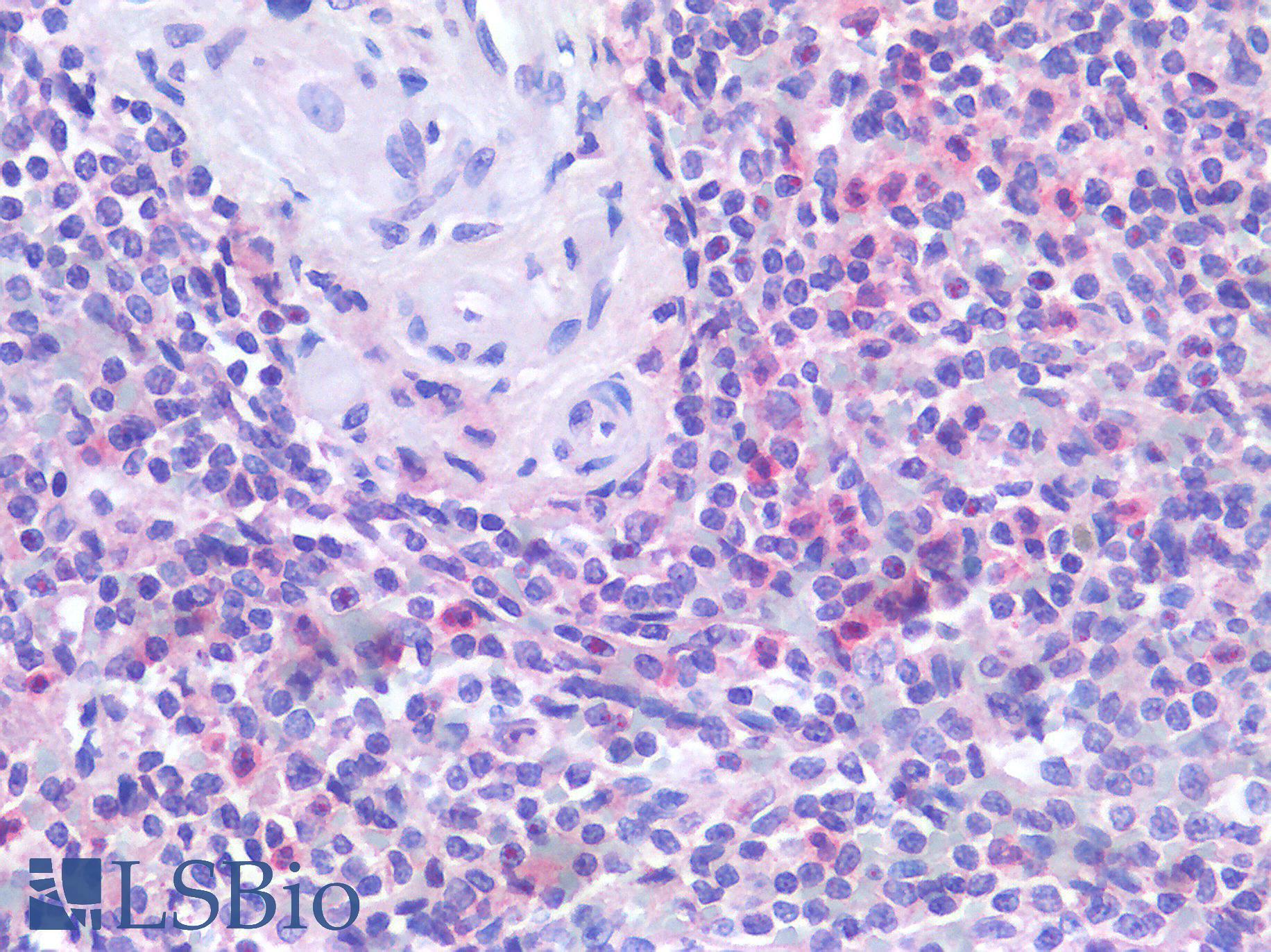 IL6R / IL6 Receptor Antibody - Human Spleen: Formalin-Fixed, Paraffin-Embedded (FFPE)