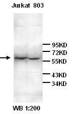 IL6R / IL6 Receptor Antibody - Western Blot analysis of Jurkat and 803 cell lysates with LS-B6362.