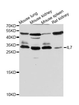 IL7 Antibody - Western blot analysis of extracts of various cell lines, using IL7 antibody at 1:500 dilution. The secondary antibody used was an HRP Goat Anti-Rabbit IgG (H+L) at 1:10000 dilution. Lysates were loaded 25ug per lane and 3% nonfat dry milk in TBST was used for blocking. An ECL Kit was used for detection and the exposure time was 30s.