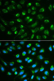 IL7 Antibody - Immunofluorescence analysis of MCF-7 cells using IL7 antibody. Blue: DAPI for nuclear staining.