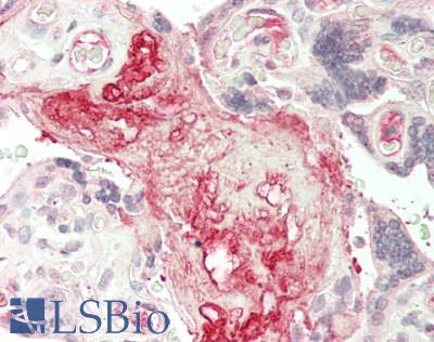 IL7R / CD127 Antibody - Human Placenta: Formalin-Fixed, Paraffin-Embedded (FFPE)