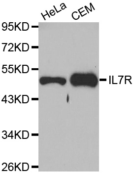 IL7R / CD127 Antibody - Western blot analysis of extracts of various cell lines, using IL7R antibody at 1:1000 dilution. The secondary antibody used was an HRP Goat Anti-Rabbit IgG (H+L) at 1:10000 dilution. Lysates were loaded 25ug per lane and 3% nonfat dry milk in TBST was used for blocking.