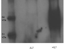 IL7R / CD127 Antibody - Anti-IL-7 Receptor alpha chain pY449 - Western Blot. Anti-IL-7 Receptor alpha chain pY449 in immunoprecipitation and Western blot. Lysates were prepared from thymocyte D1 cells treated with or without IL7 (50 ng/ml), and immunoprecipitated with anti-Phosphotyrosine conjugated to Protein G agarose. After washing and boiling, the supernatant was separated by SDS-PAGE and transferred to nitrocellulose. Western Blot analysis was performed using anti-IL7 receptor pY449, diluted 1:10000 in BSA, incubated overnight at 4°C. The proteins were visualized using an HRP-conjugated goat anti-rabbit antibody and ECL detection.