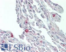 IL8 / Interleukin 8 Antibody - Human Lung: Formalin-Fixed, Paraffin-Embedded (FFPE)