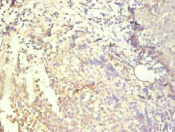 IL8 / Interleukin 8 Antibody - Immunohistochemical of paraffin-embedded human tonsil tissue using CXCL8 Monoclonal Antibody at dilution of 1:200.