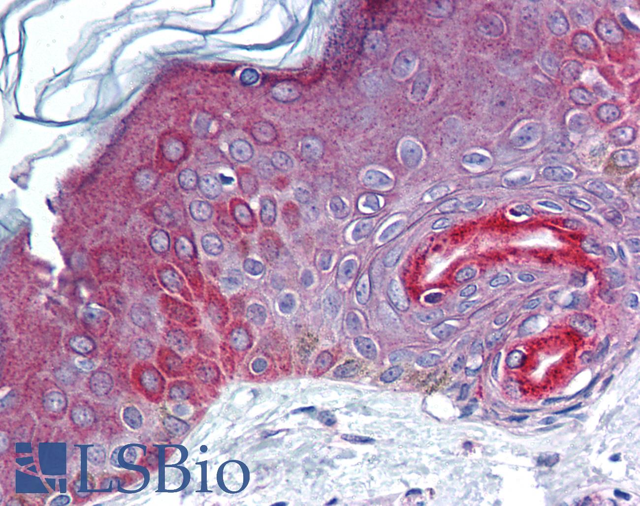 ILEI / FAM3C Antibody - Anti-FAM3C antibody IHC of human skin. Immunohistochemistry of formalin-fixed, paraffin-embedded tissue after heat-induced antigen retrieval. Antibody concentration 10 ug/ml.