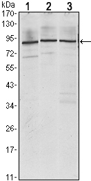 IMP-3 / IGF2BP3 Antibody - Western blot using IGF2BP3 mouse monoclonal antibody against Jurkat (1), K562 (2) and NTERA-2 (3) cell lysate.