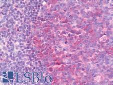 IMPDH1 Antibody - Anti-IMPDH1 antibody IHC staining of human tonsil. Immunohistochemistry of formalin-fixed, paraffin-embedded tissue after heat-induced antigen retrieval. Antibody dilution 1:100.