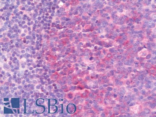 IMPDH1 Antibody - Anti-IMPDH1 antibody IHC staining of human tonsil. Immunohistochemistry of formalin-fixed, paraffin-embedded tissue after heat-induced antigen retrieval. Antibody dilution 1:100.