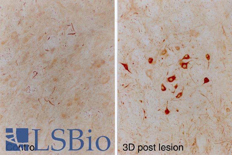 INA / Alpha Internexin Antibody - Rat facial nucleus before (left) and after (right) facial nerve lesion. Note the profound upregulation of alpha-internexin in the facial nucleus motor neurons.
