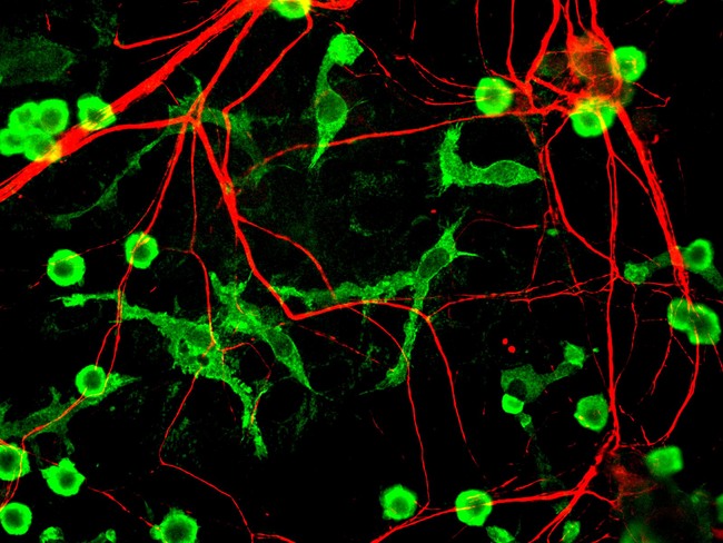 INA / Alpha Internexin Antibody - Mixed neuron glia cultures stain with INA antibody (red) and counterstained with rabbit polyclonal antibody to Coronin 1a, (green) which is an excellent marker of microglia and lymphocytes. The chicken internexin antibody is an excellent marker of neuronal processes in these cultures.