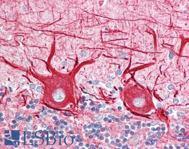 INA / Alpha Internexin Antibody - Anti-INA / Alpha Internexin antibody IHC staining of human brain, cerebellum. Immunohistochemistry of formalin-fixed, paraffin-embedded tissue after heat-induced antigen retrieval. Antibody dilution 1:500.