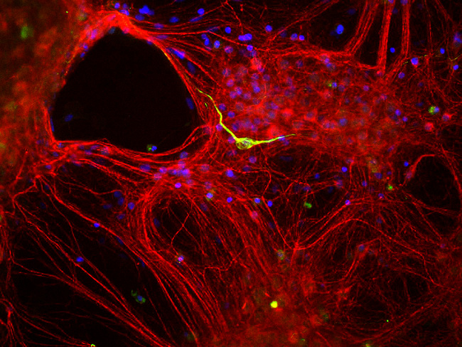 INA / Alpha Internexin Antibody - Mixed neuron-glial cultures stained with rabbit antibody to alpha-internexin (red) and chicken antibody to peripherin (green). The alpha internexin antibody stains numerous axonal and dendritic profiles in these cultures, while peripherin antibody binds to only a subset of neurons.