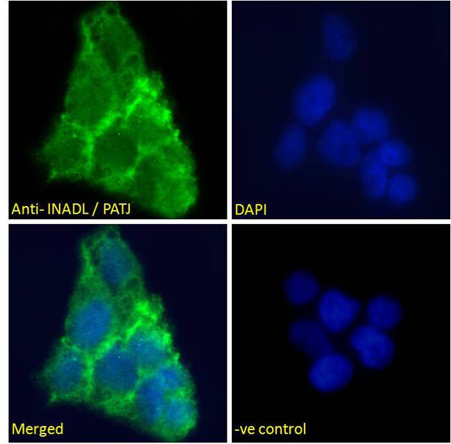INADL / PATJ Antibody - Goat Anti-INADL / PATJ Antibody Immunofluorescence analysis of paraformaldehyde fixed A431 cells, permeabilized with 0.15% Triton. Primary incubation 1hr (10ug/ml) followed by Alexa Fluor 488 secondary antibody (2ug/ml), showing junctional staining. The nuclear stain is DAPI (blue). Negative control: Unimmunized goat IgG (10ug/ml) followed by Alexa Fluor 488 secondary antibody (2ug/ml).