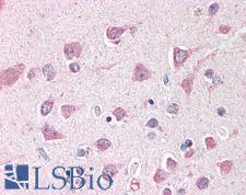 ING3 Antibody - Anti-ING3 antibody IHC of human brain, cortex. Immunohistochemistry of formalin-fixed, paraffin-embedded tissue after heat-induced antigen retrieval. Antibody concentration 5 ug/ml.