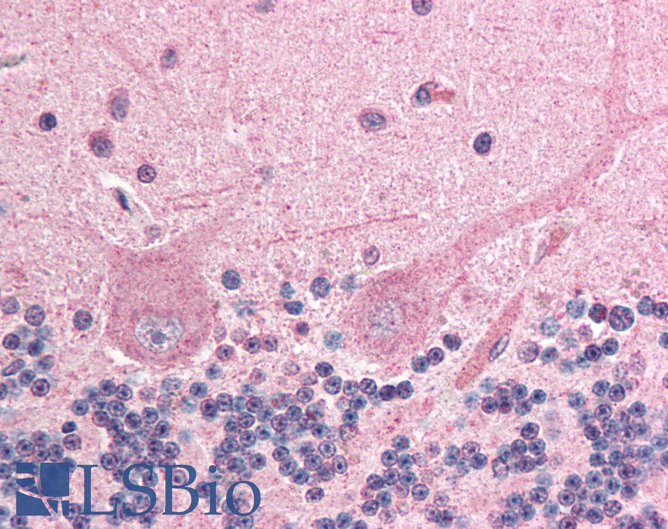 ING4 Antibody - Anti-ING4 antibody IHC of human brain, cerebellum. Immunohistochemistry of formalin-fixed, paraffin-embedded tissue after heat-induced antigen retrieval. Antibody concentration 5 ug/ml.