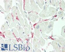 INHBB / Inhibin Beta B Antibody - Human Heart: Formalin-Fixed, Paraffin-Embedded (FFPE)