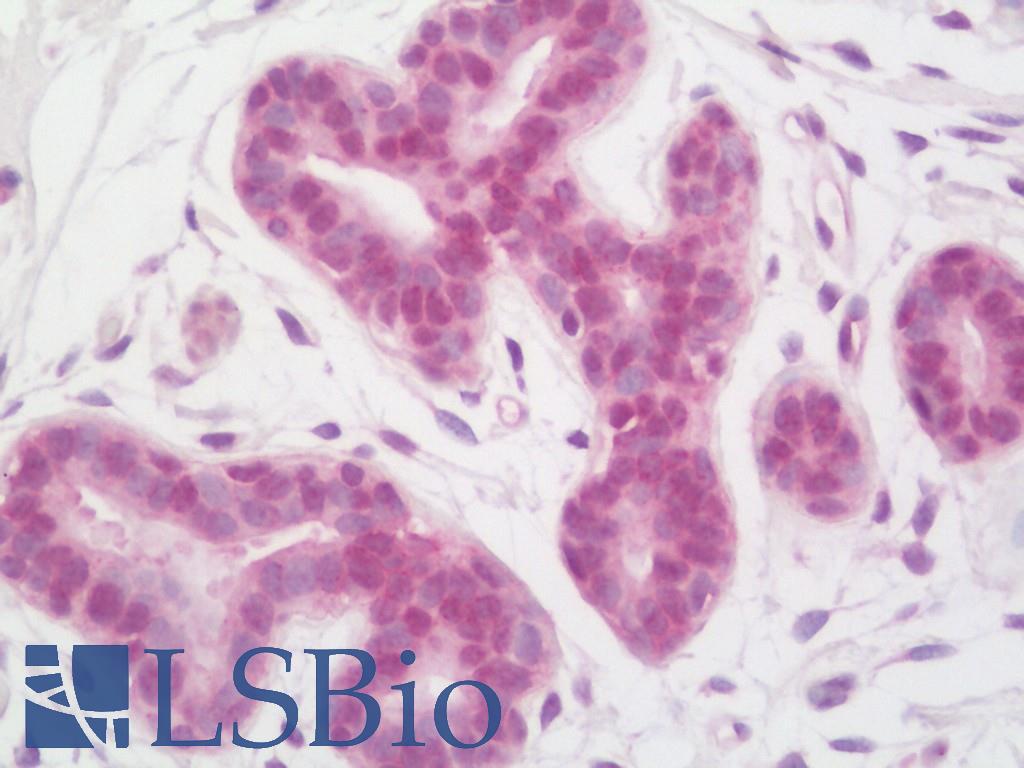INO80 Antibody - Anti-INO80 antibody IHC staining of human breast. Immunohistochemistry of formalin-fixed, paraffin-embedded tissue after heat-induced antigen retrieval. Antibody concentration 5 ug/ml.