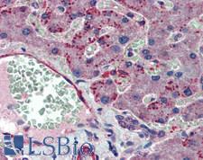 INO80 Antibody - Human Liver: Formalin-Fixed, Paraffin-Embedded (FFPE)