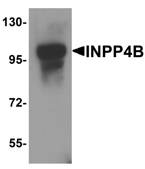 INPP4B Antibody - Western blot analysis of INPP4B in 3T3 cell lysate with INPP4B antibody at 1 ug/ml.