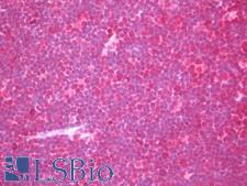 INPP5D / SHIP1 / SHIP Antibody - Anti-INPP5D / SHIP1 / SHIP antibody IHC staining of human thymus. Immunohistochemistry of formalin-fixed, paraffin-embedded tissue after heat-induced antigen retrieval. Antibody dilution 1:50.