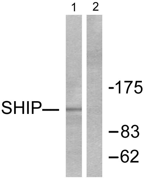INPP5D / SHIP1 / SHIP Antibody - Western blot analysis of lysates from HUVEC cells, using SHIP1 Antibody. The lane on the right is blocked with the synthesized peptide.