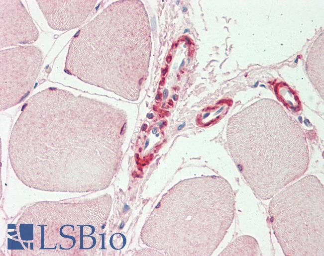 INPP5K / SKIP Antibody - Anti-INPP5K / SKIP antibody IHC staining of human skeletal muscle. Immunohistochemistry of formalin-fixed, paraffin-embedded tissue after heat-induced antigen retrieval. Antibody concentration 10 ug/ml.
