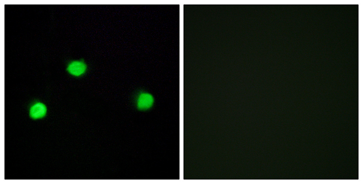 IP6K2 Antibody - Immunofluorescence analysis of COS7 cells, using IP6K2 Antibody. The picture on the right is blocked with the synthesized peptide.