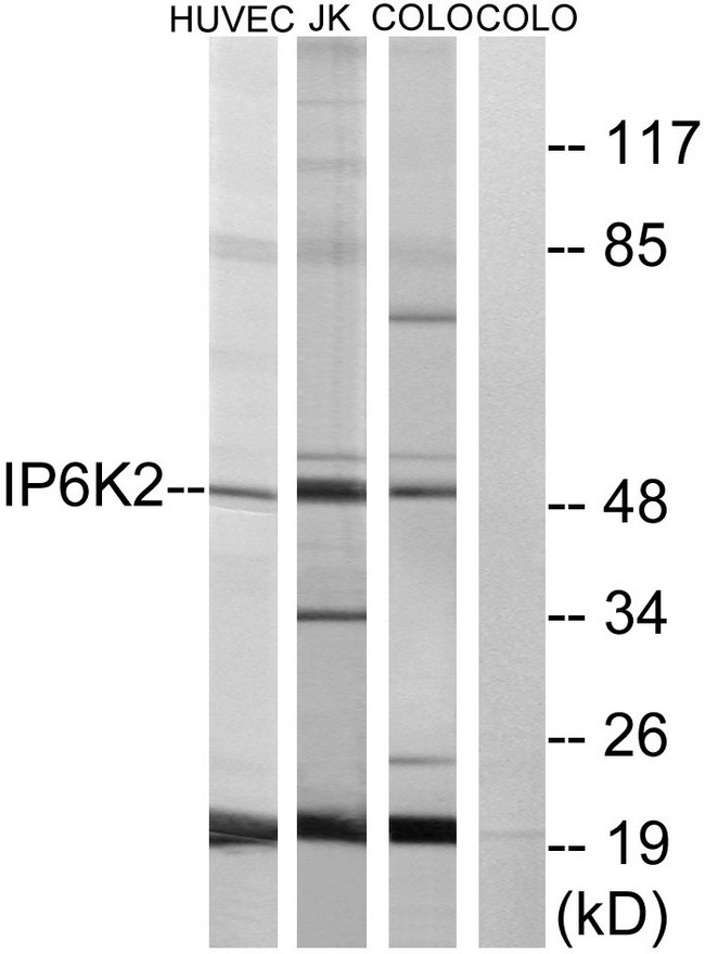 IP6K2 Antibody - Western blot analysis of lysates from HUVEC, COLO, and Jurkat cells, using IP6K2 Antibody. The lane on the right is blocked with the synthesized peptide.