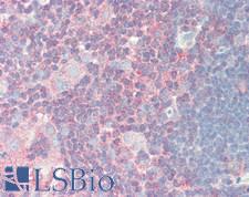 IPAF / NLRC4 Antibody - Human Thymus: Formalin-Fixed, Paraffin-Embedded (FFPE), at a dilution of 1:100. 
