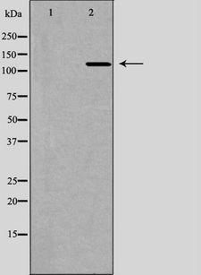 IPO5 / RANBP5 Antibody - Western blot analysis of HeLa whole cells lysates using IPO5 antibody. The lane on the left is treated with the antigen-specific peptide.