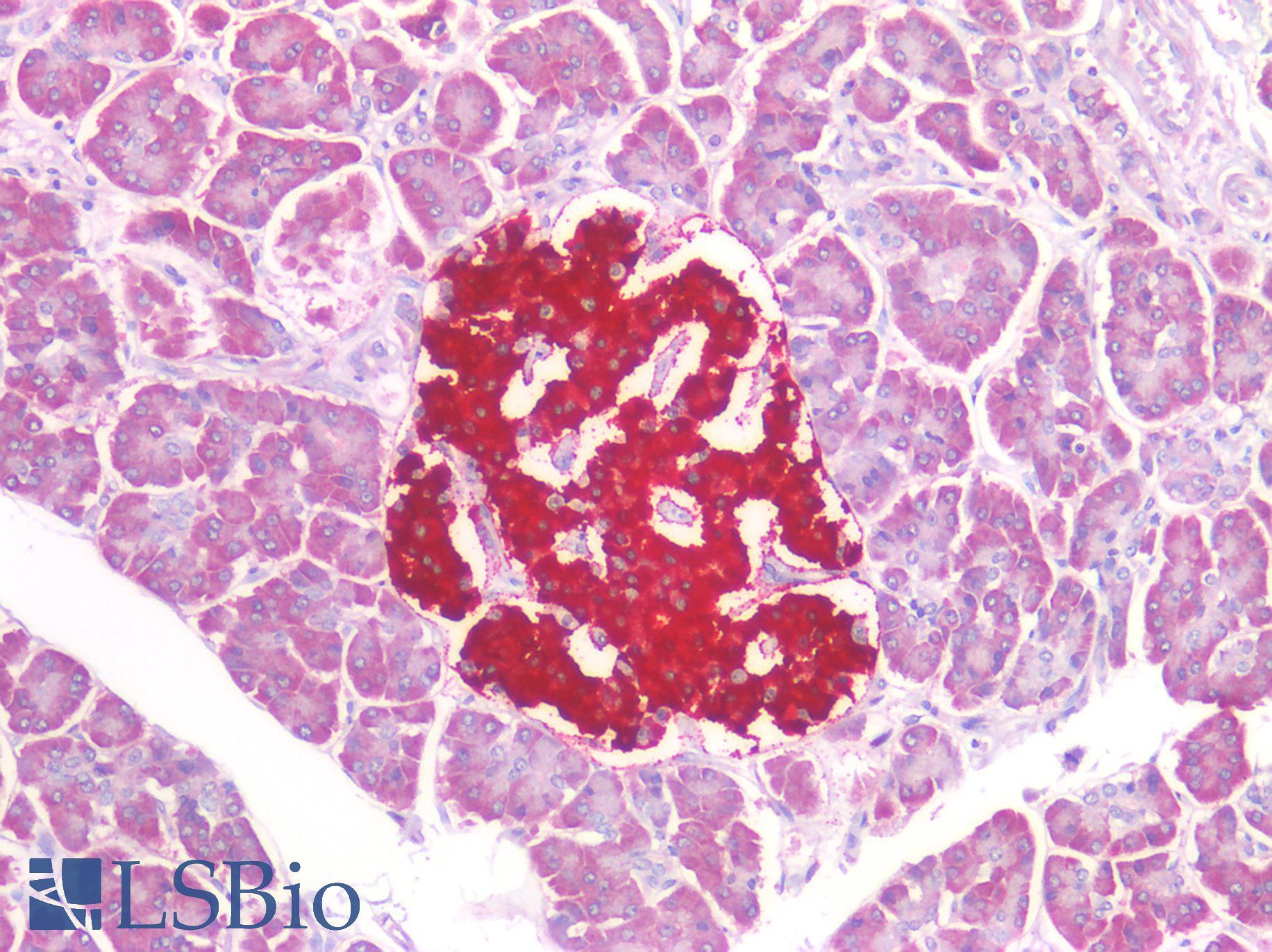 IPO5 / RANBP5 Antibody - Human Pancreas: Formalin-Fixed, Paraffin-Embedded (FFPE)