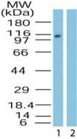 IPO9 / Importin 9 Antibody - Western blot of Importin-9 in HeLa lysate in the 1) absence and 2) presence of immunizing peptide using antibody at 0.5 ug/ml.