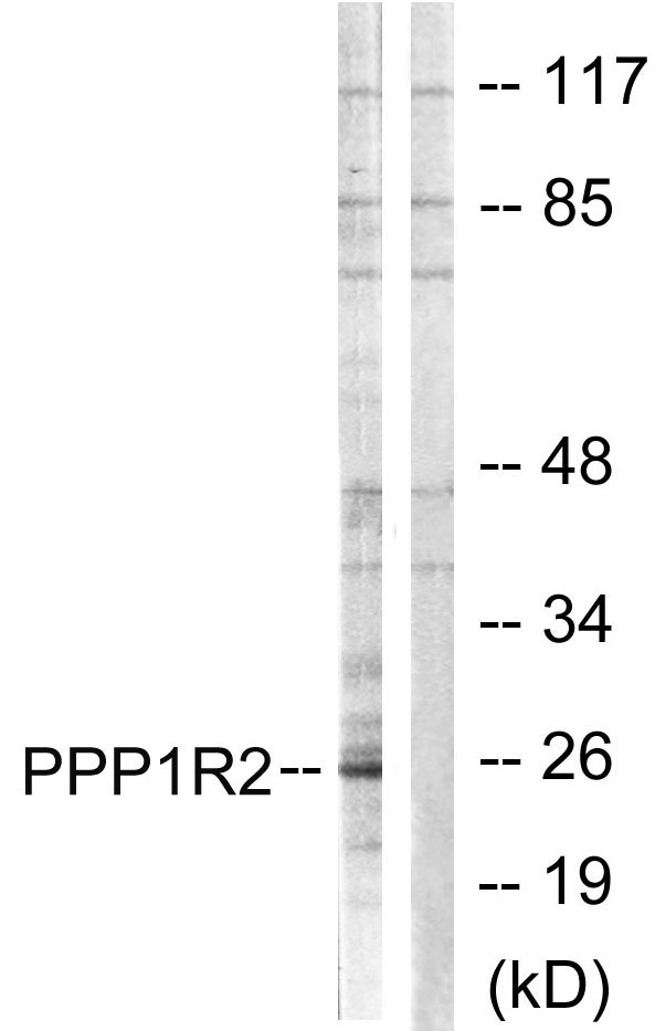 IPP2 / PPP1R2 Antibody - Western blot analysis of lysates from Jurkat cells, using PPP1R2 Antibody. The lane on the right is blocked with the synthesized peptide.
