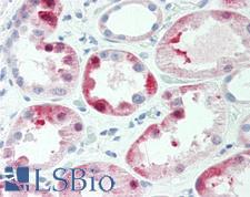 IQGAP3 Antibody - Human Kidney: Formalin-Fixed, Paraffin-Embedded (FFPE)