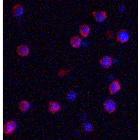 IQSEC1 Antibody - Immunofluorescence of IQSEC1 in A-20 cells with IQSEC1 antibody at 2 µg/mL.
