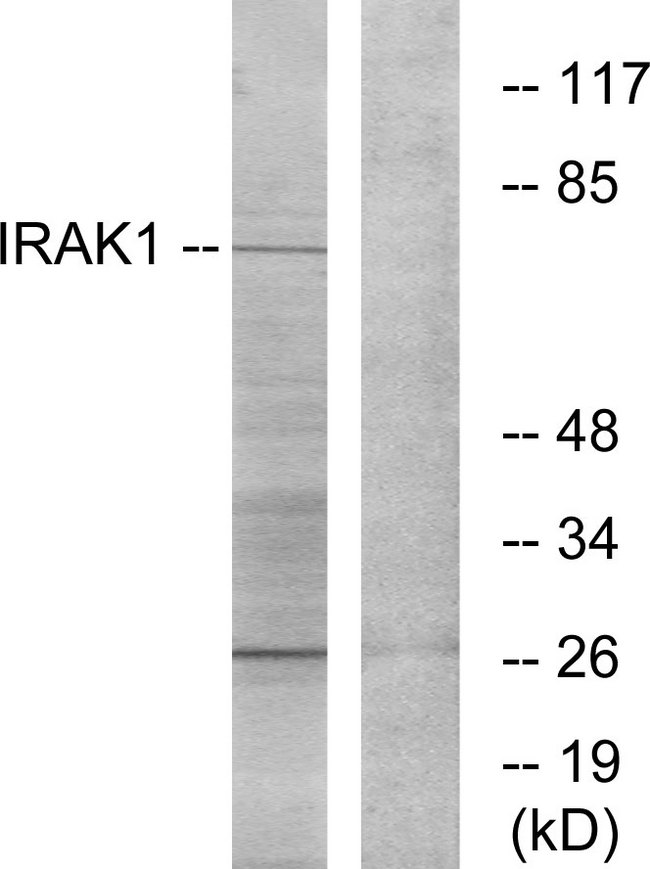 IRAK1 / IRAK Antibody - Western blot analysis of lysates from NIH/3T3 cells, using IRAK1 Antibody. The lane on the right is blocked with the synthesized peptide.