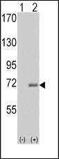 IRAK1 / IRAK Antibody - Western blot of IRAK1 (arrow) using rabbit polyclonal IRAK Antibody. 293 cell lysates (2 ug/lane) either nontransfected (Lane 1) or transiently transfected with the IRAK1 gene (Lane 2) (Origene Technologies).