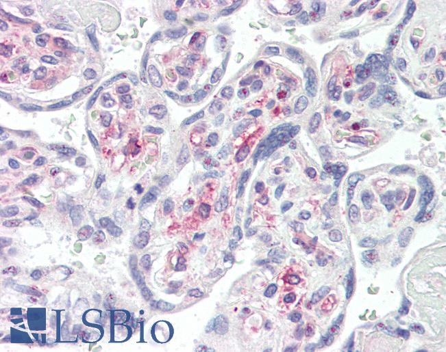 IRAK1 / IRAK Antibody - Anti-IRAK1 / IRAK antibody IHC of human placenta. Immunohistochemistry of formalin-fixed, paraffin-embedded tissue after heat-induced antigen retrieval. Antibody concentration 10 ug/ml.