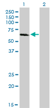 IRAK1 / IRAK Antibody - Western blot of IRAK1 expression in transfected 293T cell line by IRAK1 monoclonal antibody clone 3A9.