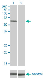 IRAK1 / IRAK Antibody - WB analysis of IRAK1 over-expressed 293 cell line, cotransfected with IRAK1 Validated Chimera RNAi (Lane 2) or non-transfected control (Lane 1). Blot probed with IRAK1 MAb clone 3A9. GAPDH ( 36.1 kD ) used as specificity and loading control.