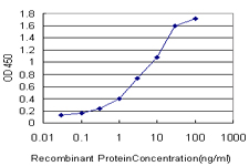 IRAK1 / IRAK Antibody - Detection limit for recombinant GST tagged IRAK1 is approximately 0.03 ng/ml as a capture antibody.