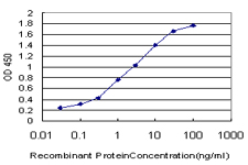 IRAK1 / IRAK Antibody - Detection limit for recombinant GST tagged IRAK1 is approximately 0.1 ng/ml as a capture antibody.