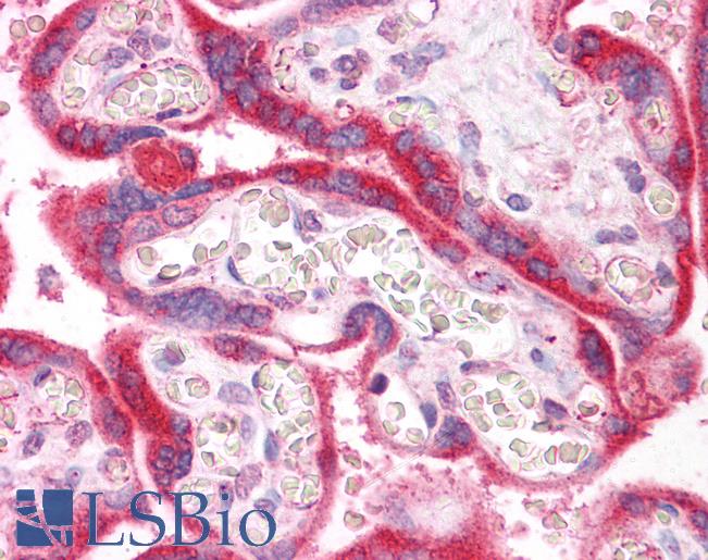 IRAK1 / IRAK Antibody - Anti-IRAK1 / IRAK antibody IHC of human placenta. Immunohistochemistry of formalin-fixed, paraffin-embedded tissue after heat-induced antigen retrieval. Antibody concentration 5 ug/ml.