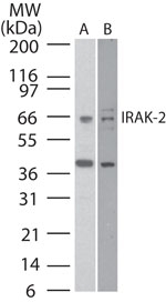 IRAK2 / IRAK-2 Antibody - Western blot of IRAK-2 in 15 ugs of Jurkat cell lysate using antibody at 1 ug/ml.