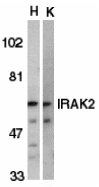 IRAK2 / IRAK-2 Antibody - Western blot of IRAK2 in HeLa (H) and K562 (K) whole cell lysate with IRAK2 antibody at 2 ug/ml.