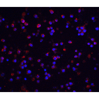 IRAK2 / IRAK-2 Antibody - Immunofluorescence of IRAK-M in human spleen tissue with IRAK M antibody at 20 µg/mL.Green: IRAK-2 Antibody  Blue: DAPI staining