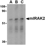 IRAK2 / IRAK-2 Antibody - Western blot of IRAK2 in RAW264.7 whole cell lysate with mIRAK2 antibody at (A) 0.5, (B) 1, and (C) 2 ug/ml.