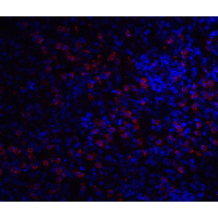 IRAK3 / IRAKM / IRAK-M Antibody - Immunofluorescence of IRAK2 in A20 cells with IRAK2 antibody at 20 µg/mL.Red: IRAK-M Antibody  Blue: DAPI staining